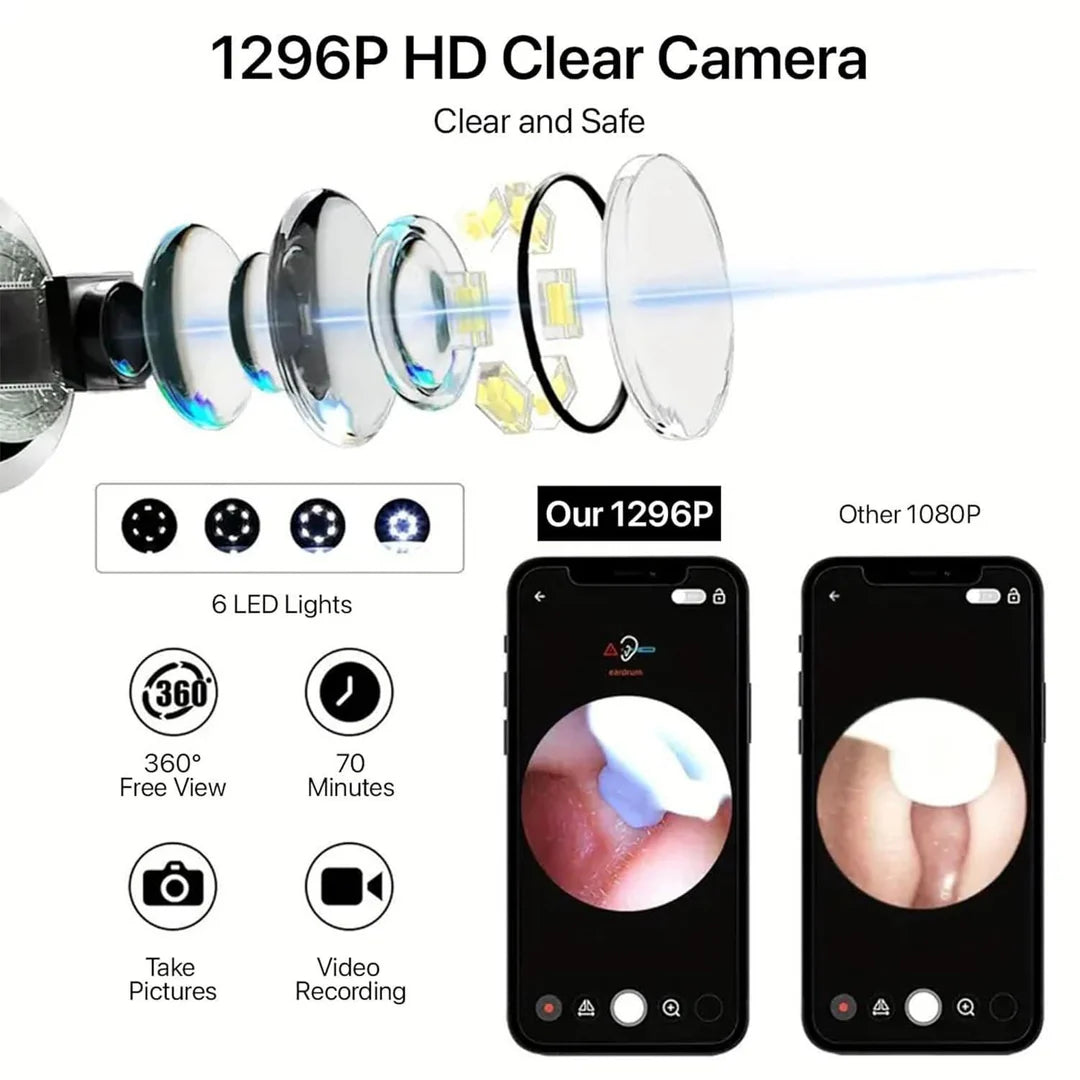 Smart Visual Ear Wax Cleaner